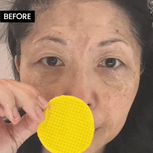 Kojic Buy 1 Get 1 Free Turmeric & Kojic Acid (60×2) Cleansing Pads (100% Geniuan)