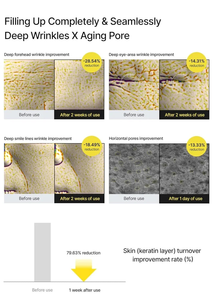 BUY 1 GET 1 FREE Celimax The Vita-A Retinal Shot with 0.1% Retinal, Matrixyl & Niacinamide for Wrinkles & Glow